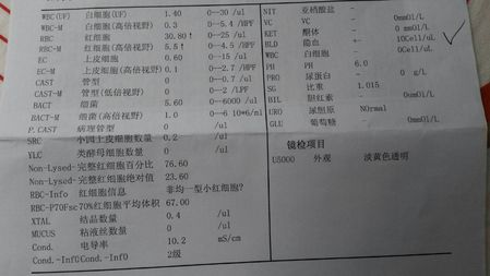 出现水肿、血尿是什么情况?小心是肾小球肾炎找上你!