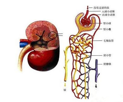 IgA肾病是什么病?为什么会得IgA肾病?