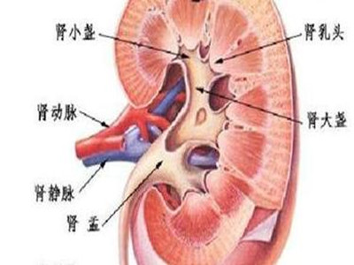 狼疮性肾炎的形成原因