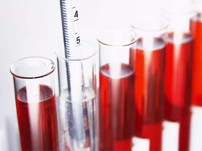 血尿，如何鉴别诊断?看双博肾病专科医生全方位解析血尿的前因后果